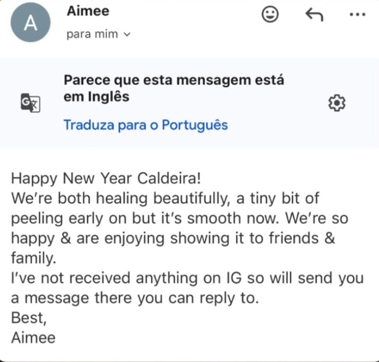 Feedbacks